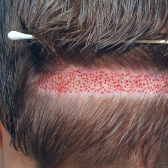 Hair SpecialistinLahore